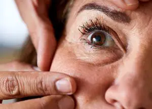 Dark Circles Under Eyes Time Clinic