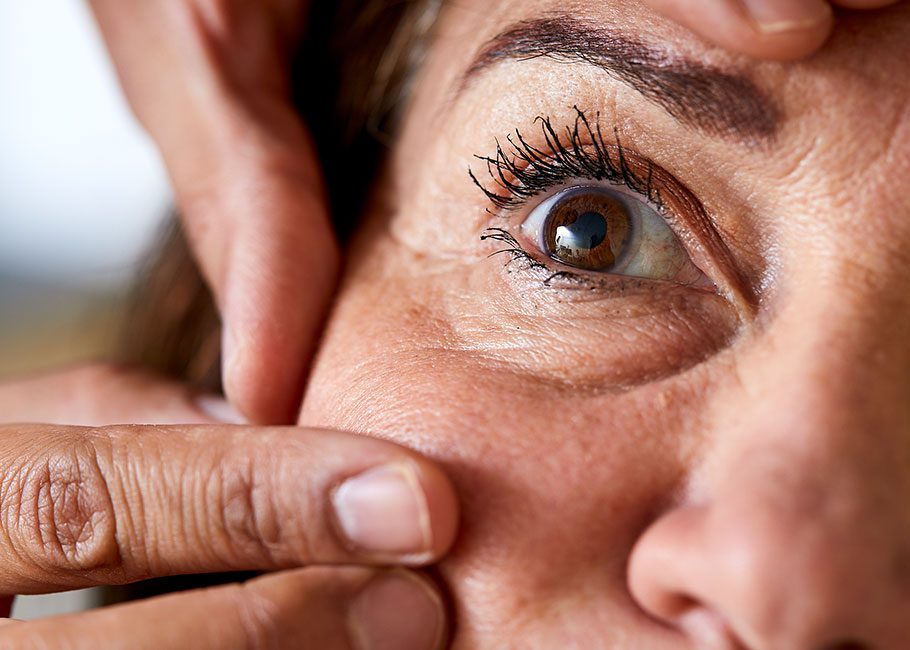 Dark Circles Under Eyes: Causes, Treatment, and Remedies