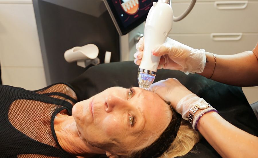 Collagen induction therapy Essex