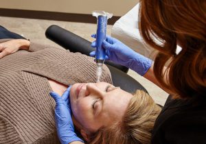 What is Microneedling and How Does It Benefit Your Skin?